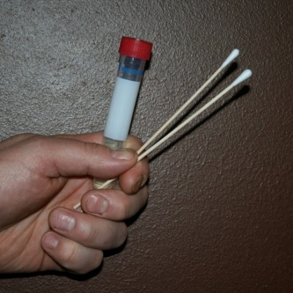 DNA sýnataka á höfuðborgarsvæðinu